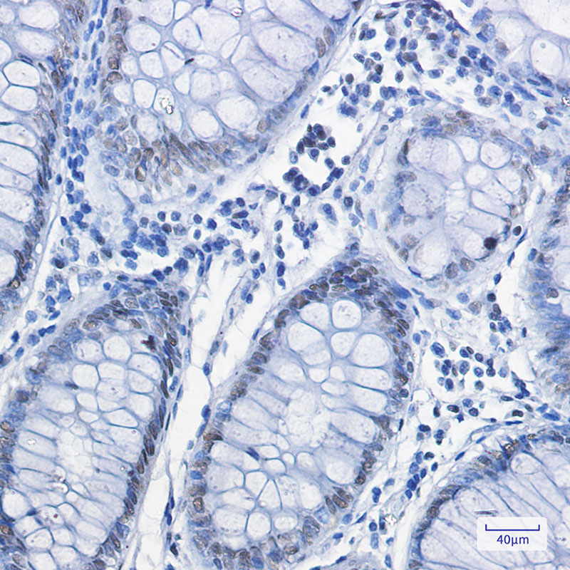 FUBP1/FBP Rabbit mAb ABZ1927