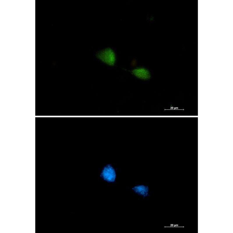 FUBP1/FBP Rabbit mAb ABZ1928
