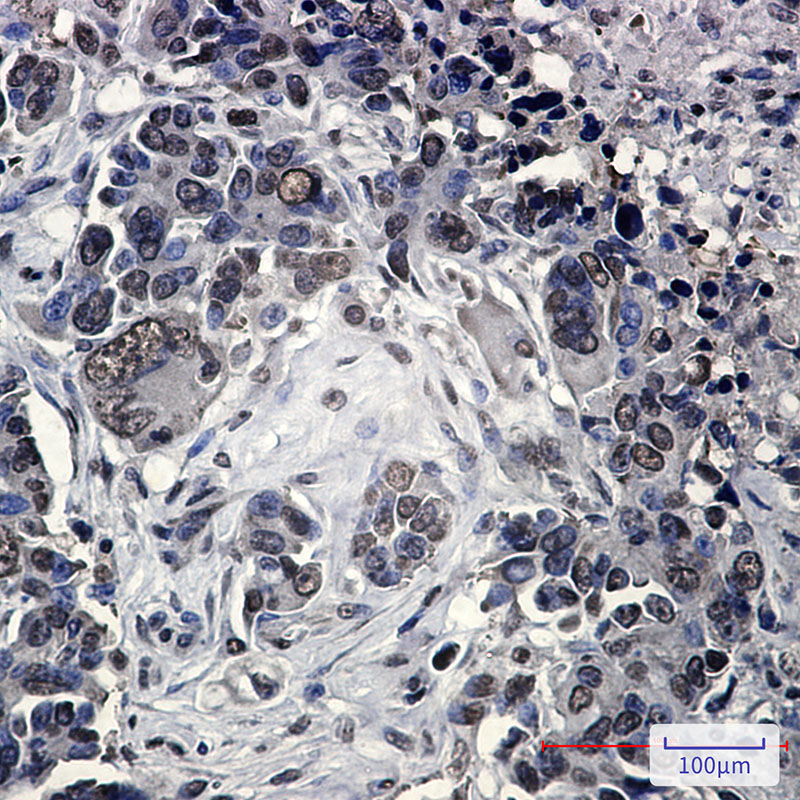 FUBP1/FBP Rabbit mAb ABZ1928