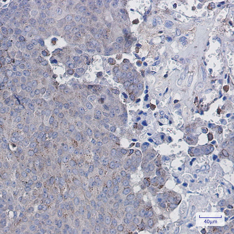 Adipose Triglyceride Lipase Rabbit mAb ABZ1929