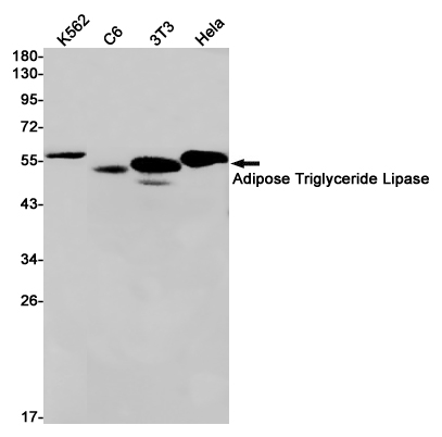 Adipose Triglyceride Lipase Rabbit mAb ABZ1929