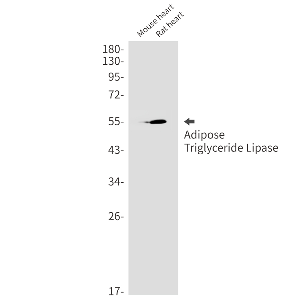Adipose Triglyceride Lipase Rabbit mAb ABZ1930