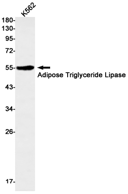 Adipose Triglyceride Lipase Rabbit mAb ABZ1930
