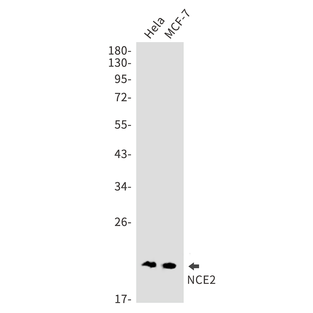 NCE2 Rabbit mAb ABZ1931