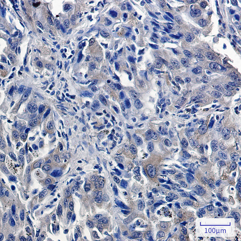 USP7 Rabbit mAb ABZ1935