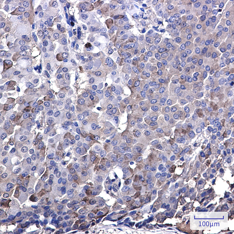 IRF7 Rabbit mAb ABZ1938