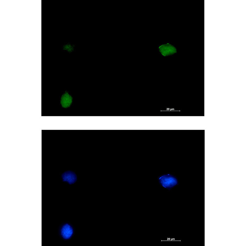 SMARCC1/BAF155 Rabbit mAb ABZ1940