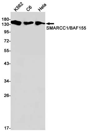 SMARCC1/BAF155 Rabbit mAb ABZ1940