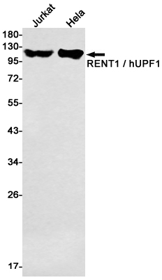 RENT1 Rabbit mAb ABZ1941