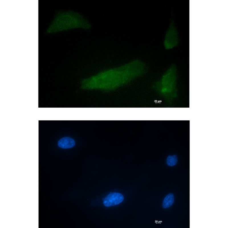 CUG BP1 Rabbit mAb ABZ1943
