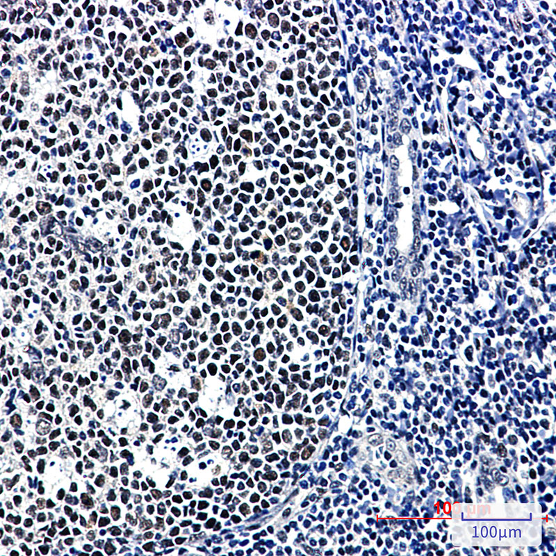 CUG BP1 Rabbit mAb ABZ1943