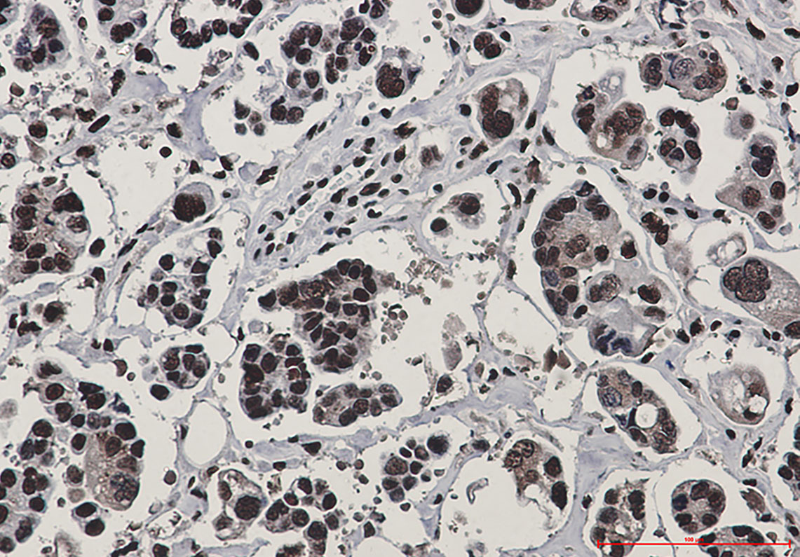 Rad50 Rabbit mAb ABZ1944