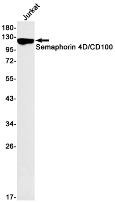SEMA4D Rabbit mAb ABZ1945