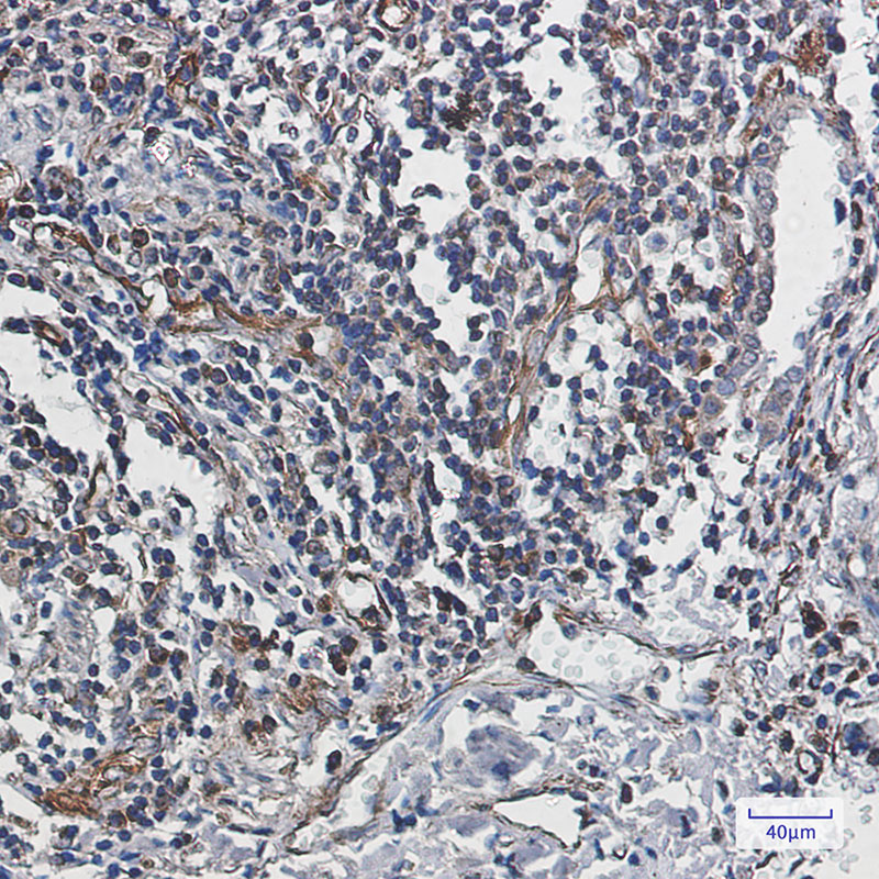 Caspase-10/CASP-10 Rabbit mAb ABZ1946