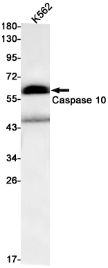 Caspase-10/CASP-10 Rabbit mAb ABZ1946