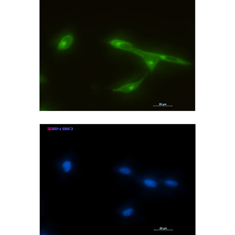 FRAT1 Rabbit mAb ABZ1947