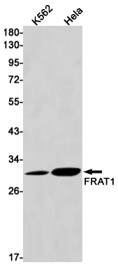 FRAT1 Rabbit mAb ABZ1947