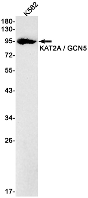 KAT2A Rabbit mAb ABZ1949