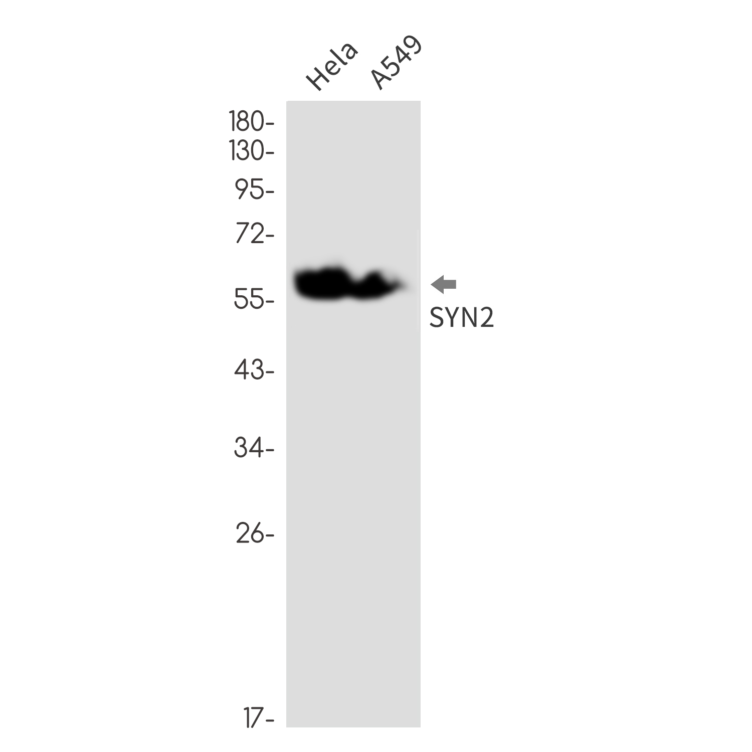 SYN2 Rabbit mAb ABZ1952