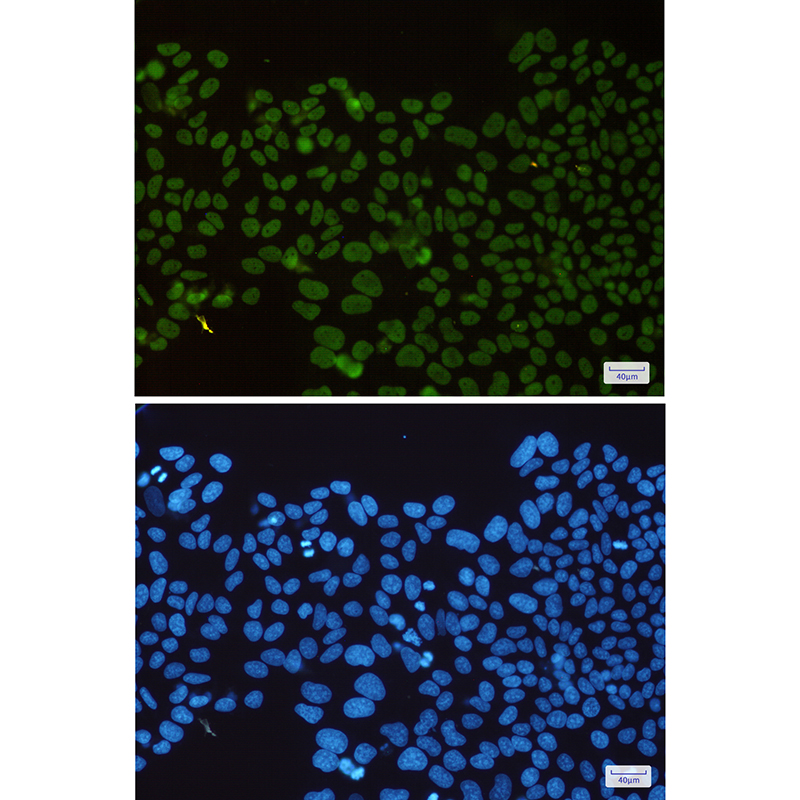 HDAC2 Rabbit mAb ABZ1953