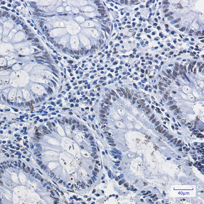 HDAC2 Rabbit mAb ABZ1953