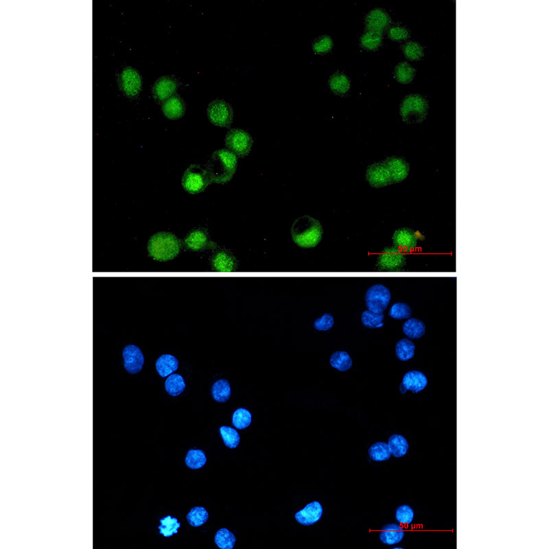 AP2 gamma/TFAP2C Rabbit mAb ABZ1954