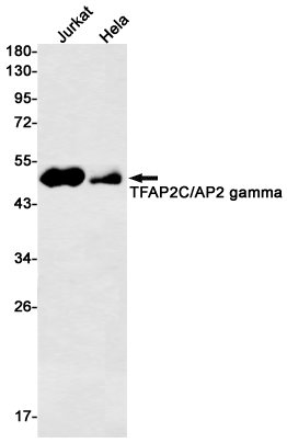 AP2 gamma/TFAP2C Rabbit mAb ABZ1954