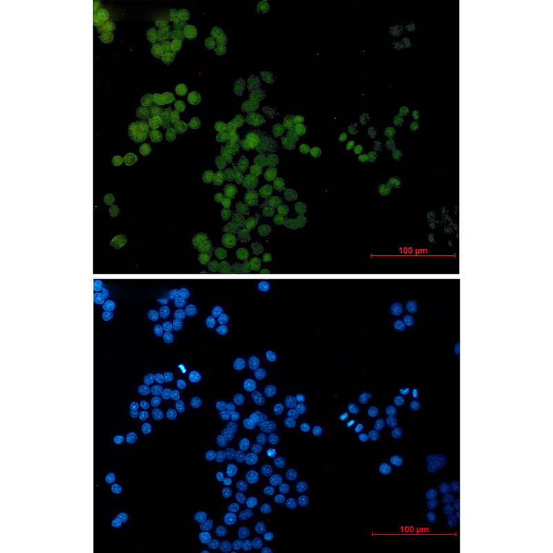 AP2 gamma/TFAP2C Rabbit mAb ABZ1955