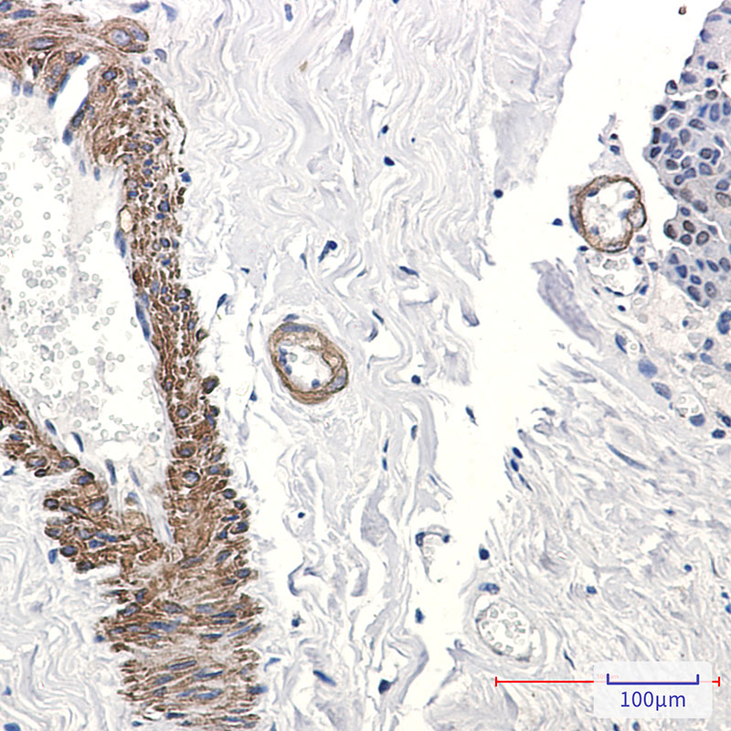AP2 gamma/TFAP2C Rabbit mAb ABZ1955