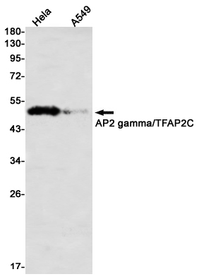 AP2 gamma/TFAP2C Rabbit mAb ABZ1955