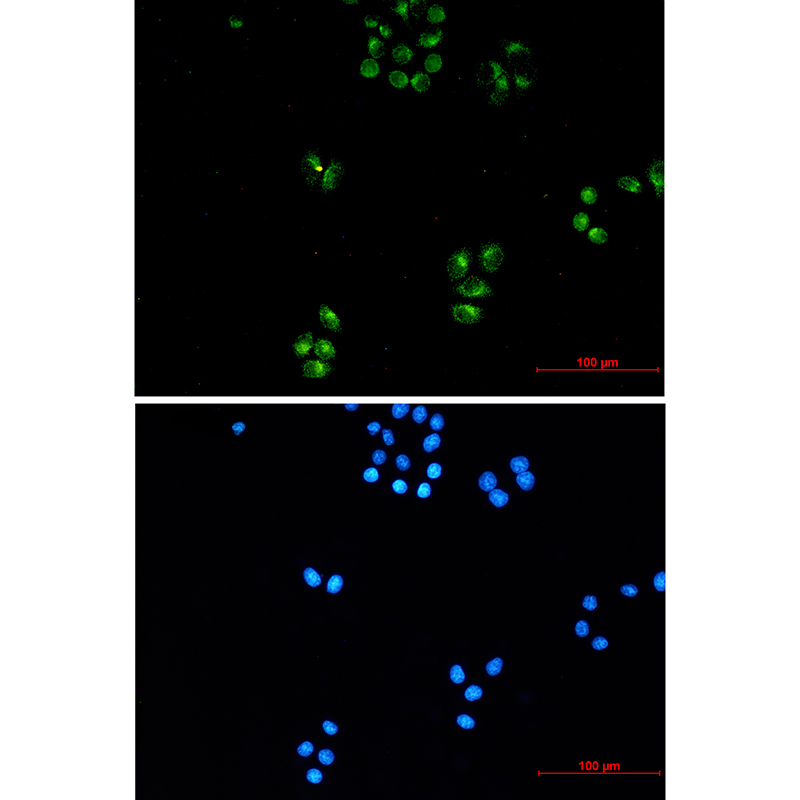 TFG Rabbit mAb ABZ1956