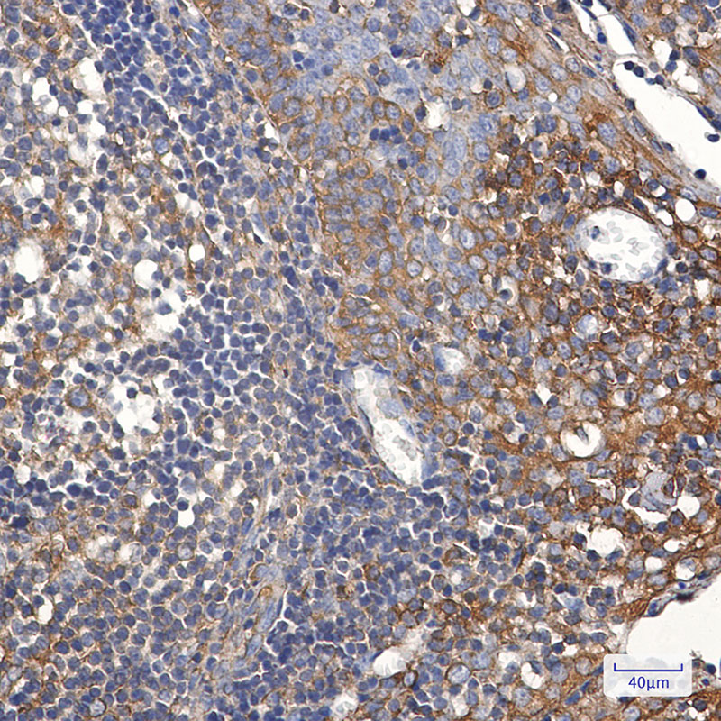 TFG Rabbit mAb ABZ1956