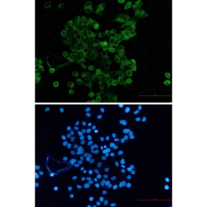 Nectin 2 Rabbit mAb ABZ1957
