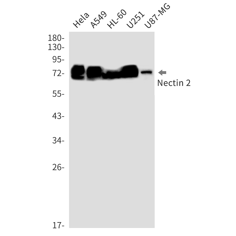 Nectin 2 Rabbit mAb ABZ1957