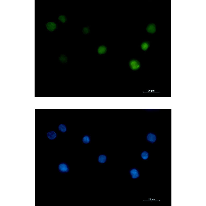 PHAPI2 Rabbit mAb ABZ1958