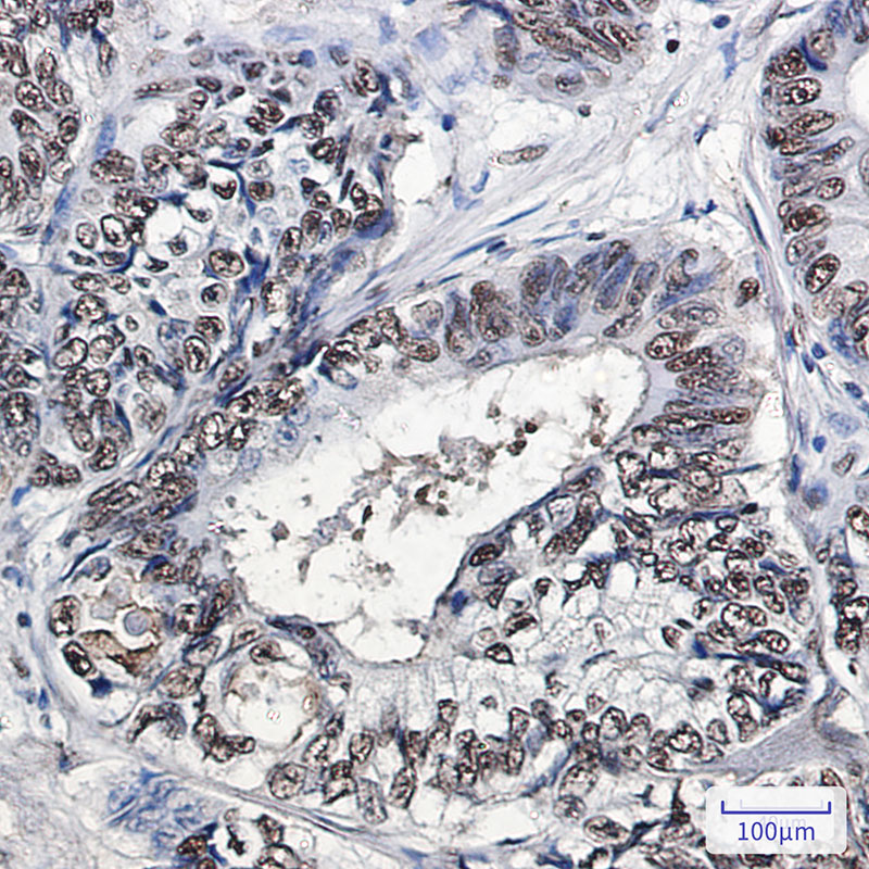 PHAPI2 Rabbit mAb ABZ1958