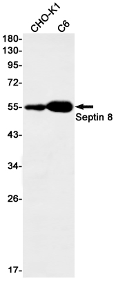 Septin 8 Rabbit mAb ABZ1961