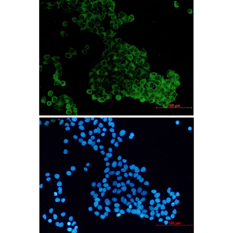 DENN Rabbit mAb ABZ1970