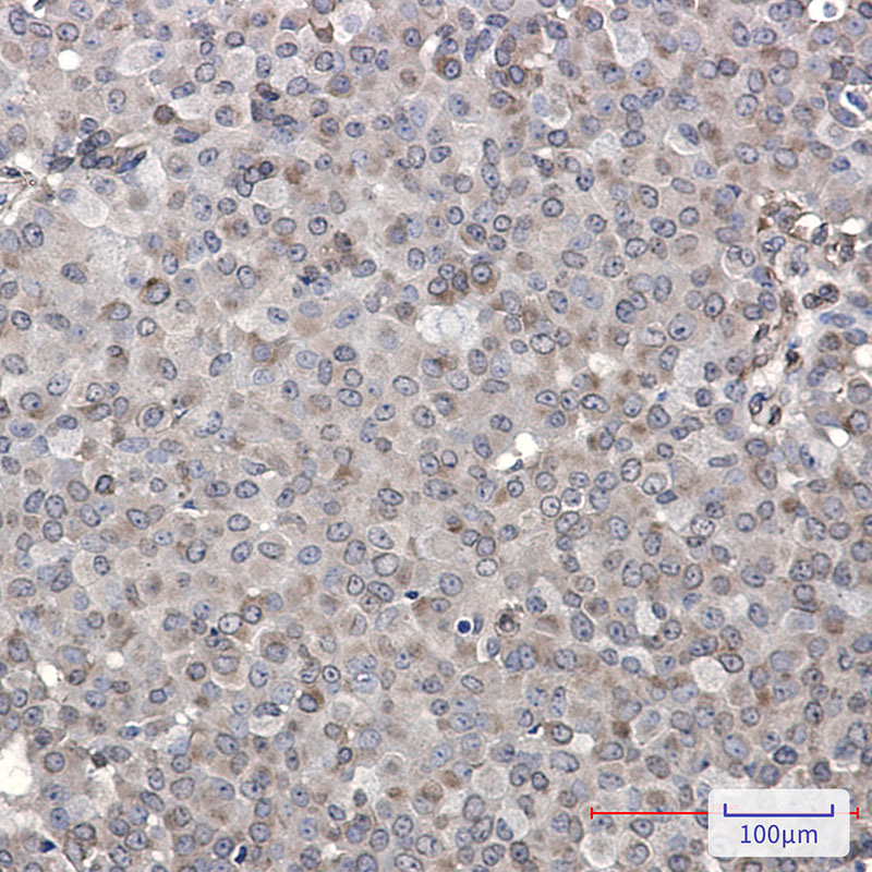 DENN Rabbit mAb ABZ1970