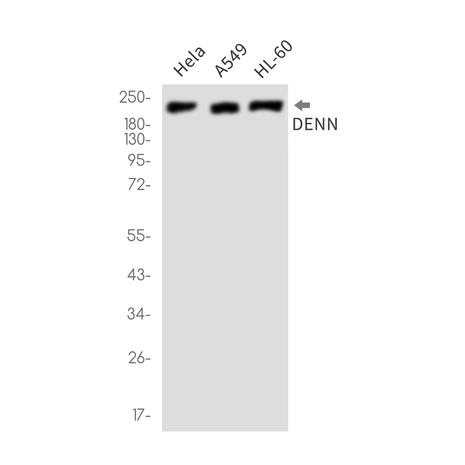 DENN Rabbit mAb ABZ1970