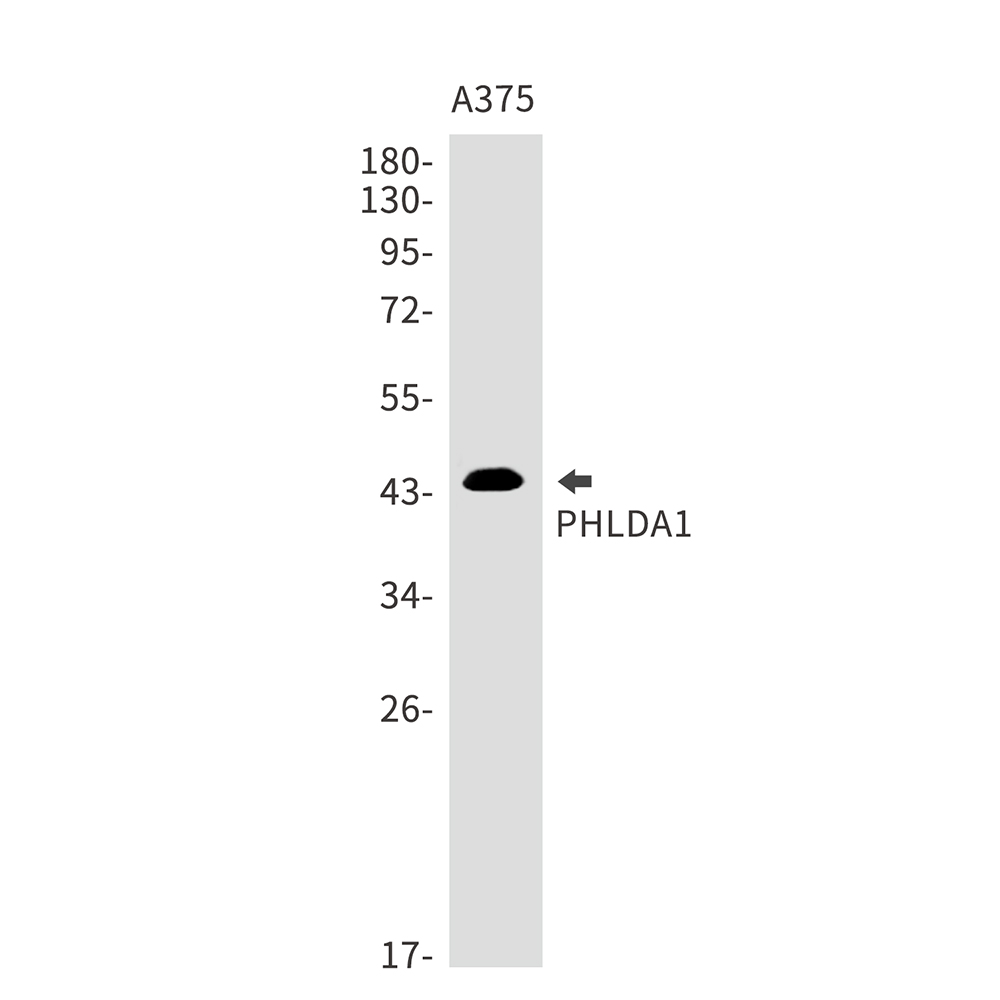 PHLDA1 Rabbit mAb ABZ1972