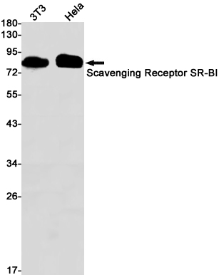 SR-BI Rabbit mAb ABZ1976