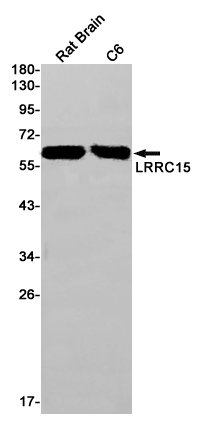LRRC15 Rabbit mAb ABZ1979