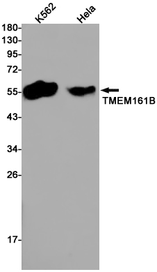 Transmembrane Protein 161B Rabbit mAb ABZ1987