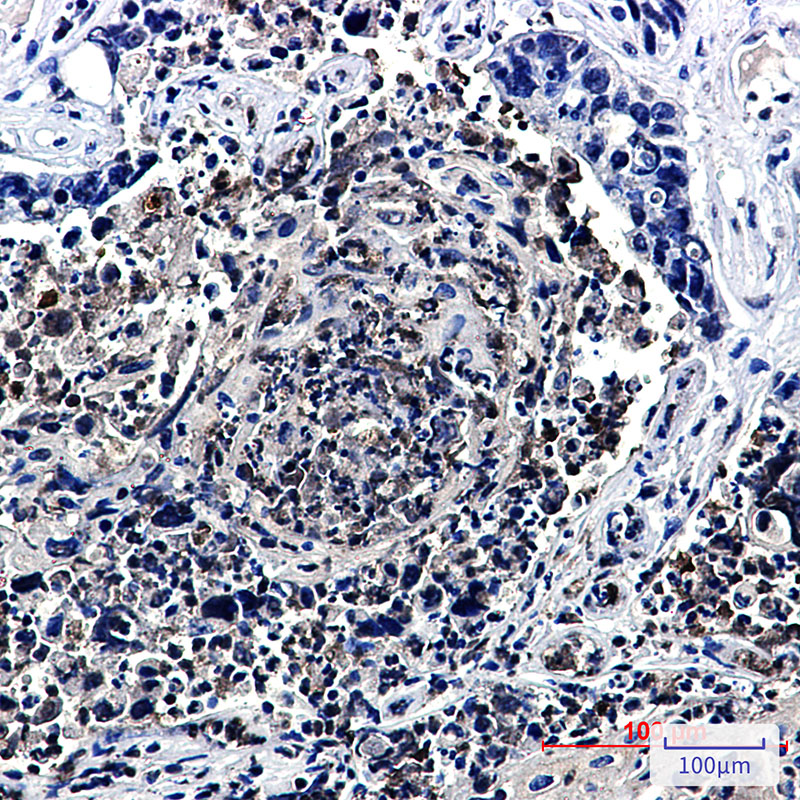 HJURP Rabbit mAb ABZ1988