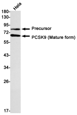 PCSK9 Rabbit mAb ABZ1989