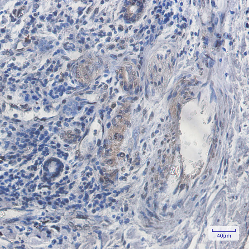 SCAI Rabbit mAb ABZ1992