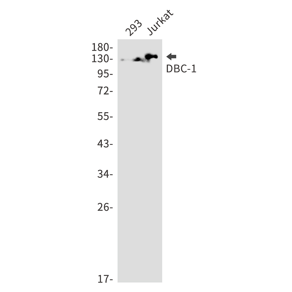 DBC 1 Rabbit mAb ABZ1994