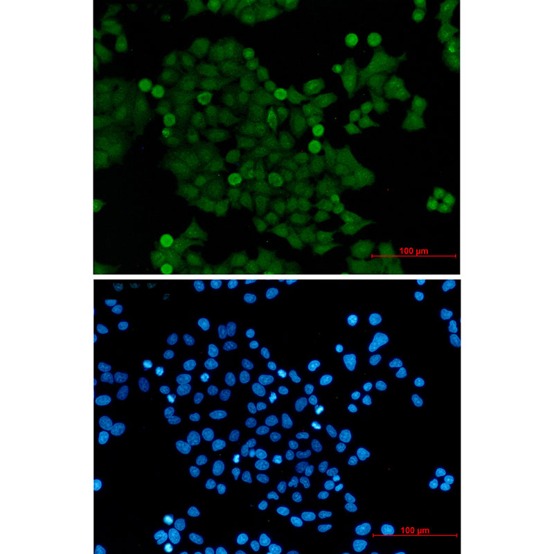 PELP1 Rabbit mAb ABZ1996