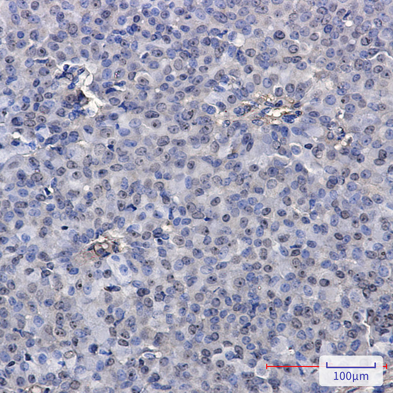 PELP1 Rabbit mAb ABZ1996